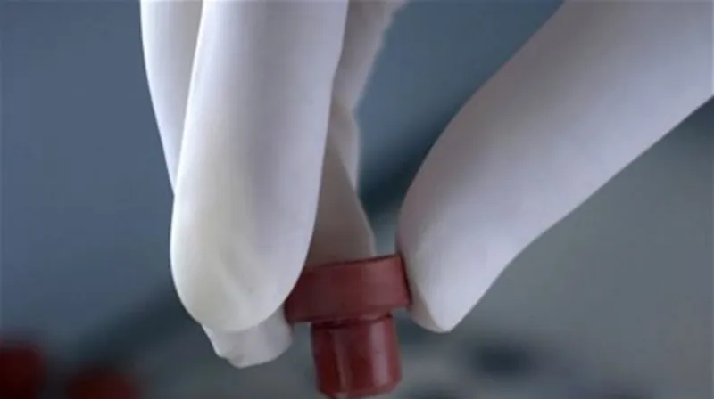 Falošný doktor zo zariadenia pre seniorov je obvinený aj z vedomého šírenia HIV - Regióny - Správy - Pravda.sk