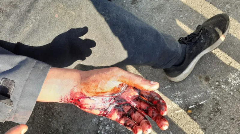 Amnesty International tvrdí, že Chorváti mučia migrantov. Tí to odmietajú - Svet - Správy - Pravda.sk