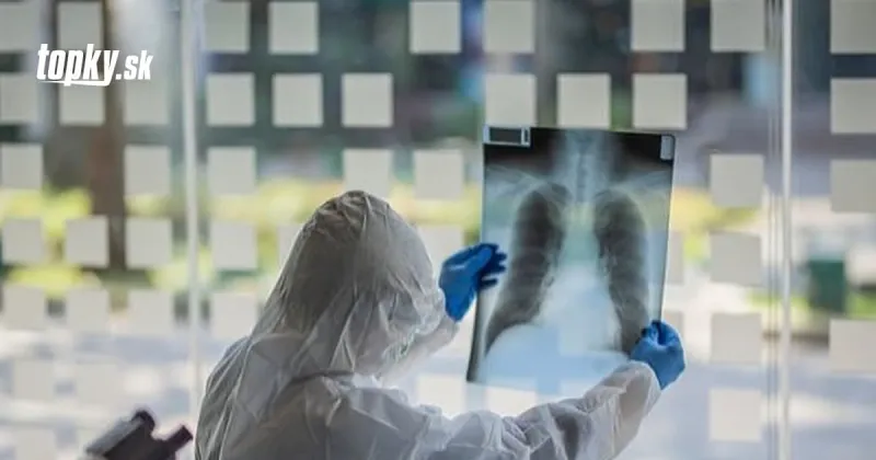 KORONAVÍRUS Novým kalifornským variantom sa znovu nakazila osoba vyliečená z covidu | Topky.sk