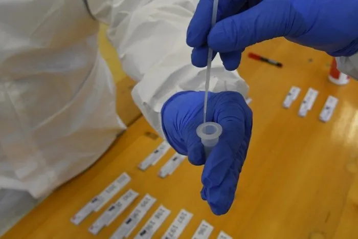 Počet obetí sa opäť zvýšil, koronavírus zachytili u ďalších vyše 1500 ľudí | Dnes24.sk