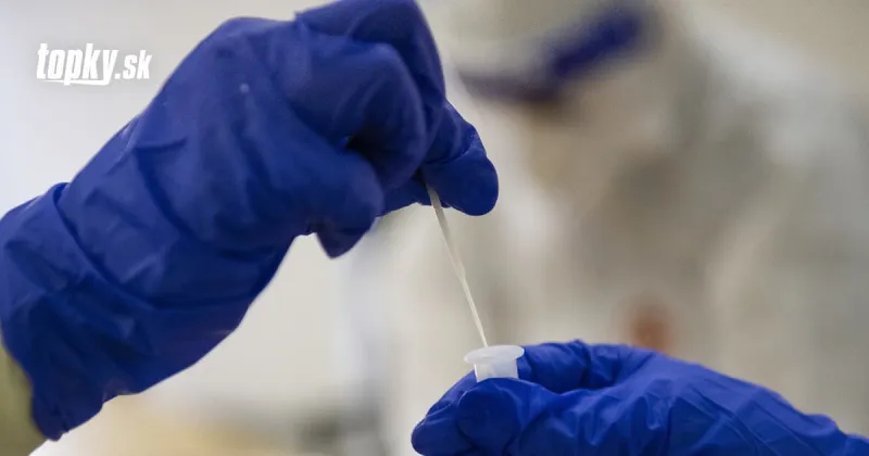 KORONAVÍRUS Na Slovensku naďalej dominuje britský variant: Potvrdili ho vo vyše 97 percentách vzoriek | Topky.sk