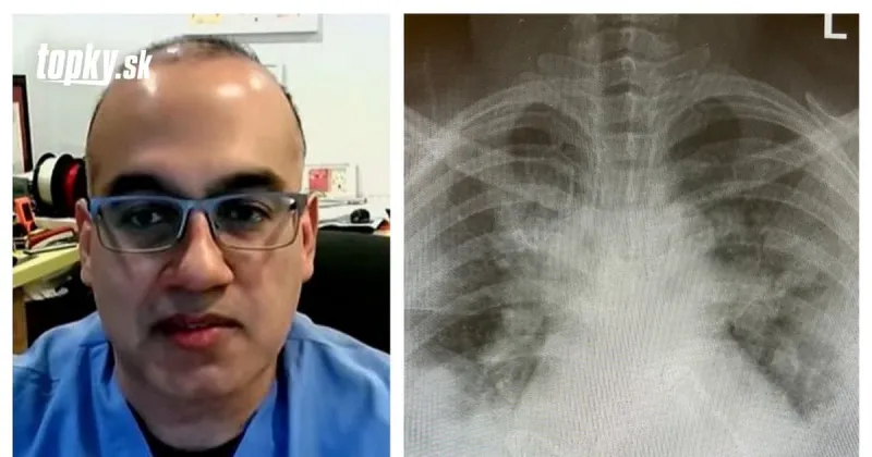 Lekár zverejnil varovné FOTO: Dajte si pozor! Takto KORONAVÍRUS dokáže zničiť pľúca! | Topky.sk