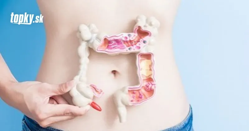 Ochrana pred vážnym priebehom KORONAVÍRUSU: Nakŕmte črevo správnymi potravinami | Topky.sk