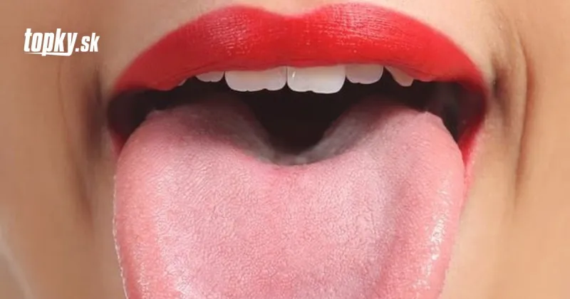 KORONAVÍRUS Po očkovaní si skontrolujte jazyk: Ako ho máte takýto, je to problém | Topky.sk