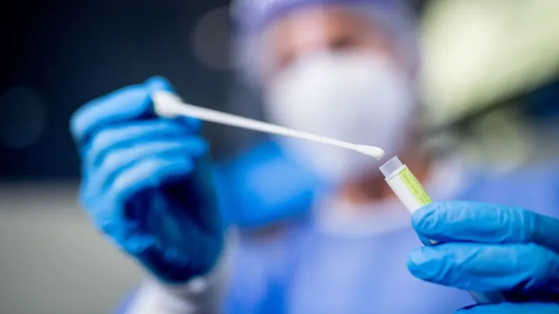 Na Slovensku pribudlo 102 prípadov koronavírusu a štyri obete - Domáce - Správy - Pravda.sk