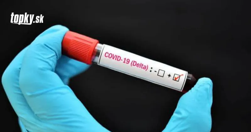 KORONAVÍRUS Variant delta je o 60 percent nákazlivejší než alfa: Hrozivá prognóza na koniec leta | Topky.sk
