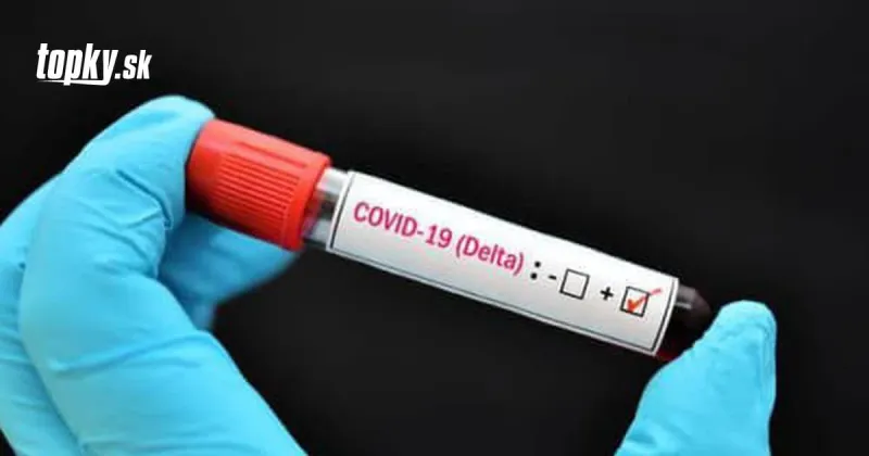KORONAVÍRUS Na Slovensku odhalili vyše 40 prípadov nákazy: Pribudli aj obete | Topky.sk