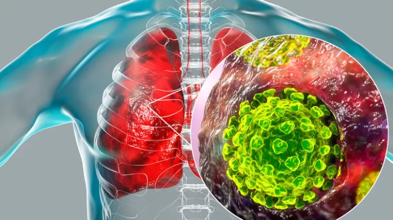 V Belgicku zomrela žena nakazená dvoma variantmi koronavírusu naraz - Svet - Správy - Pravda.sk