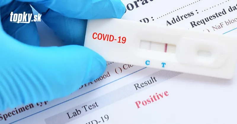 KORONAVÍRUS Česko mení pravidlá! Už nestačí čestné vyhlásenie o vykonaní testu | Topky.sk