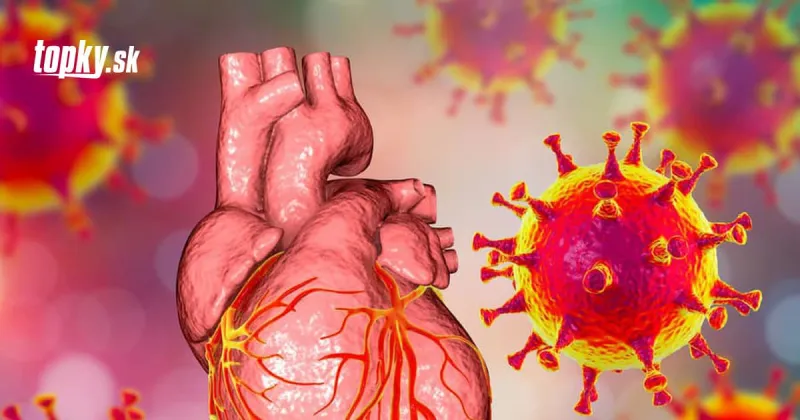 Zápal srdca po očkovaní proti KORONAVÍRUSU: Postihuje najmä TÚTO skupinu ľudí | Topky.sk