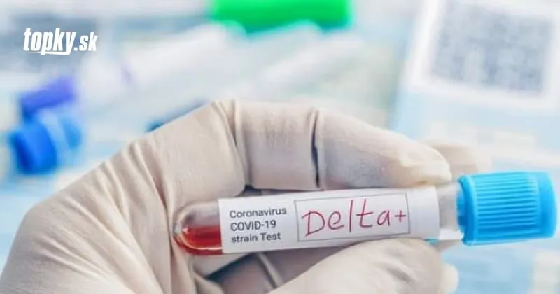KORONAVÍRUS Počet pozitívnych stúpa: Na Slovensku odhalili vyše 100 nových prípadov! | Topky.sk