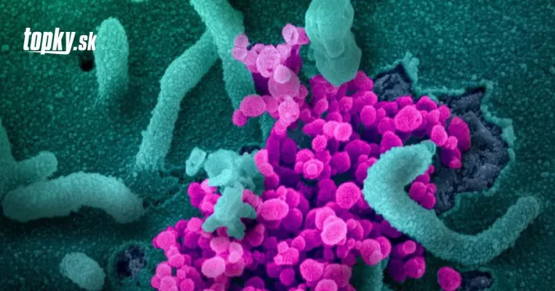 Záhada objasnená: Prečo je koronavírus pre deti väčšinou neškodný? | Topky.sk