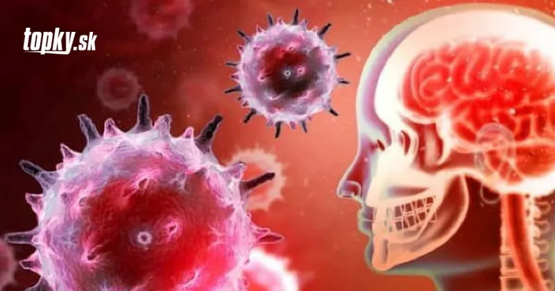 KORONAVÍRUS Štúdia k mozgovým trombózam: Smrteľným následkom očkovania sa dá zabrániť | Topky.sk