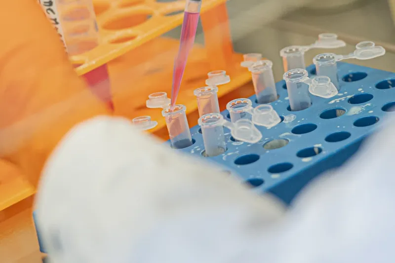 Hygienici sa pozreli na prítomnosť koronavírusu v odpadových vôd: Vieme, v koľkých vzorkách sa potvrdil | Nový Čas