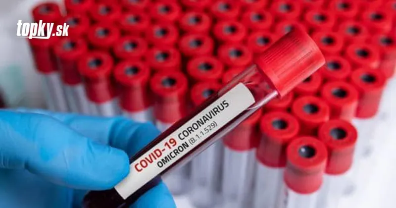 KORONAVÍRUS Česko má zrejme druhý prípad variantu omikron | Topky.sk