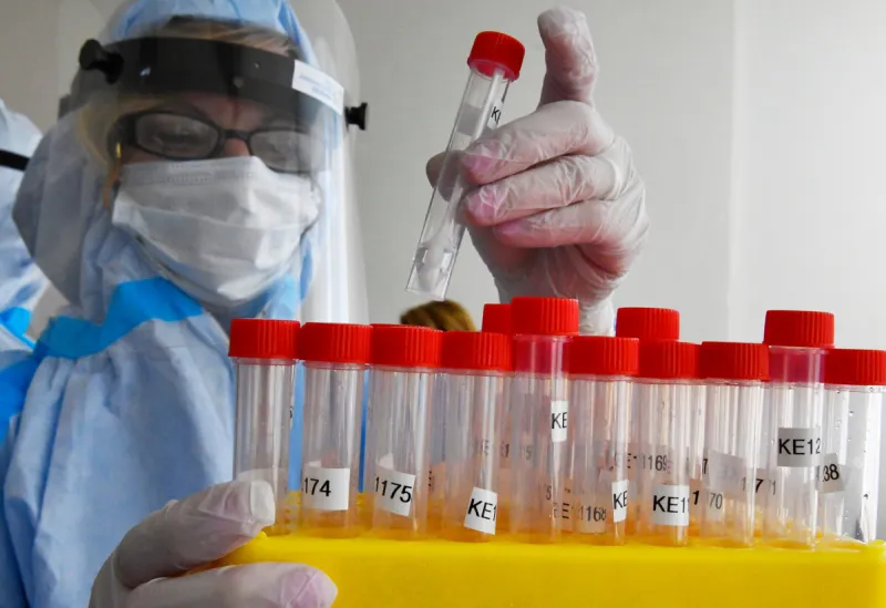 Nové prípady nákazy koronavírusom za dnes (13. 12. 2021) - SME