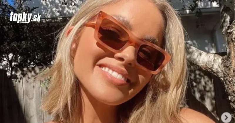 Kráska (29) sa nakazila KORONAVÍRUSOM: Trpela poriadne nezvyčajným a vtipným príznakom | Topky.sk