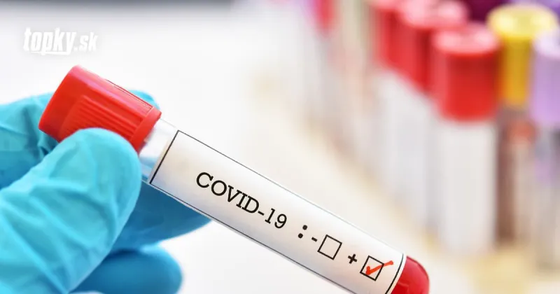 KORONAVÍRUS Štátnu tajomníčku v Británii nezastavil ani pozitívny test: Pokračovala v stretnutí | Topky.sk