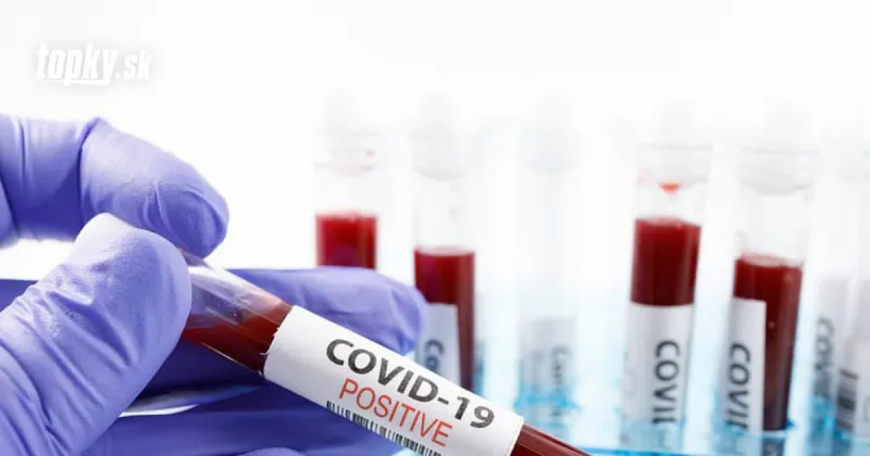 Slováci bojujú s KORONAVÍRUSOM: Pribudlo ďalších 18-tisíc nových prípadov a 24 obetí | Topky.sk