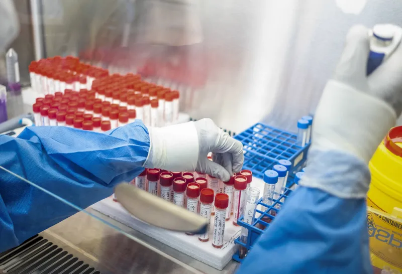 Koronavírus zistili takmer vo všetkých skúmaných vzorkách odpadových vôd - SME