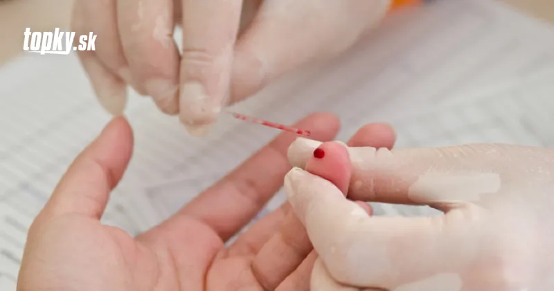 Máte túto krvnú skupinu? Prečítajte si, čo to pre vás znamená v súvislosti s KORONAVÍRUSOM | Topky.sk