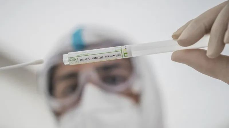 Koronavírus ešte Slovensko neopustil: Kde bolo najviac pozitívne testovaných a kto končí v nemocnici? | Nový Čas