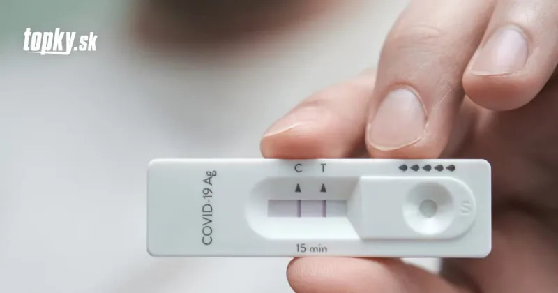 KORONAVÍRUS Na Slovensku odhalili 2477 nových prípadov: Pribudlo 27 obetí | Topky.sk