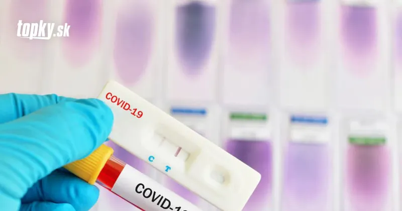 KORONAVÍRUS Dobré správy pre pendlerov: Do Rakúska môžu vstúpiť bez obmedzení | Topky.sk