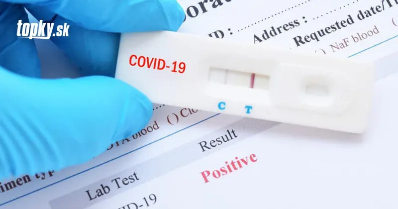 KORONAVÍRUS Na Slovensku pribudlo vyše 2-tisíc nových prípadov a 17 obetí | Topky.sk