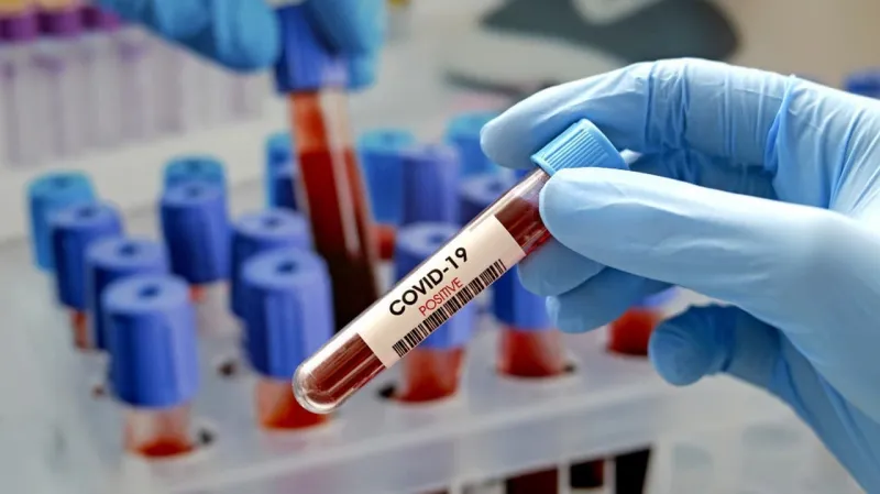 Najdlhší známy prípad ochorenia COVID-19: Koronavírus mal v tele 505 dní | Nový Čas